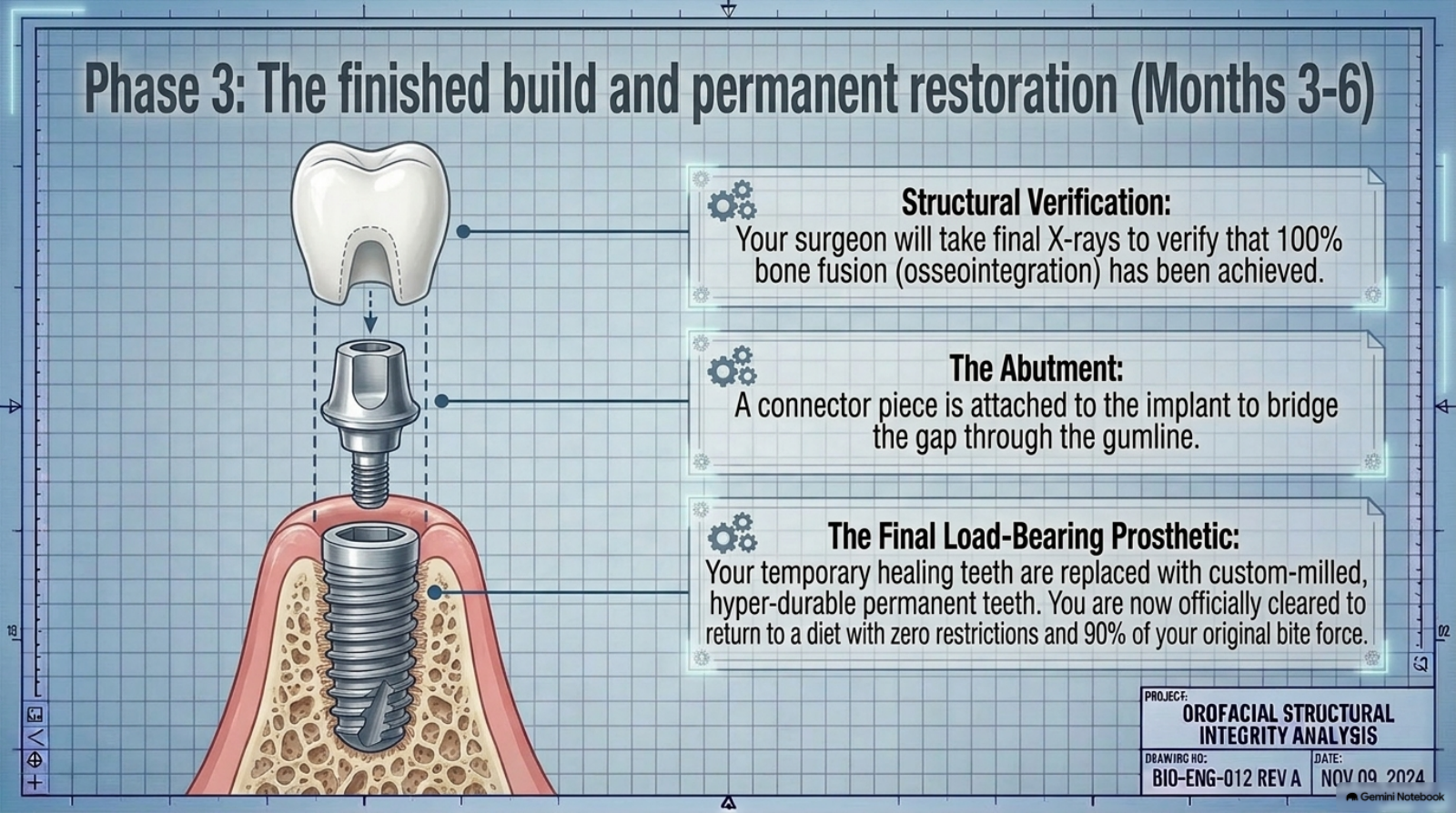Slide 13: Phase 3 — permanent restoration months 3-6, abutment and final teeth